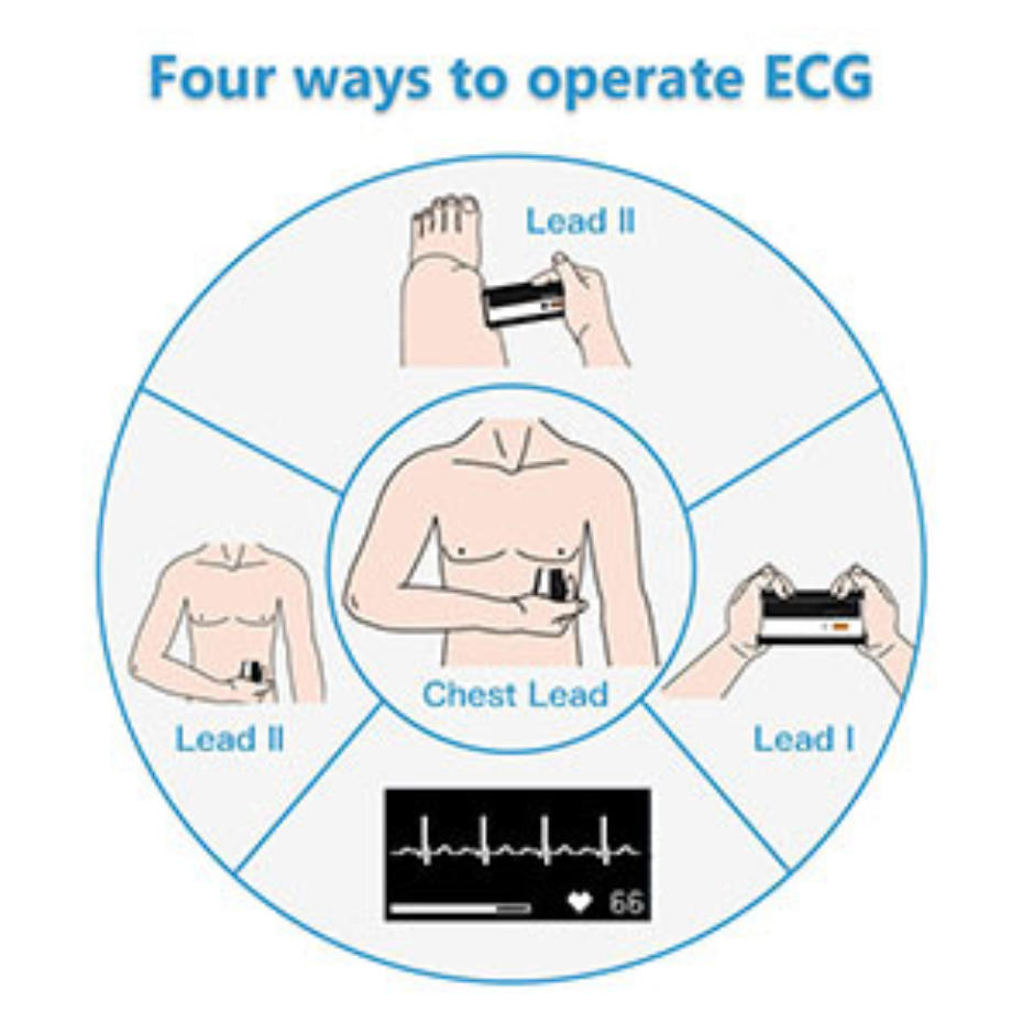 Marsden BP2 Blood Pressure Monitor with ECG 1